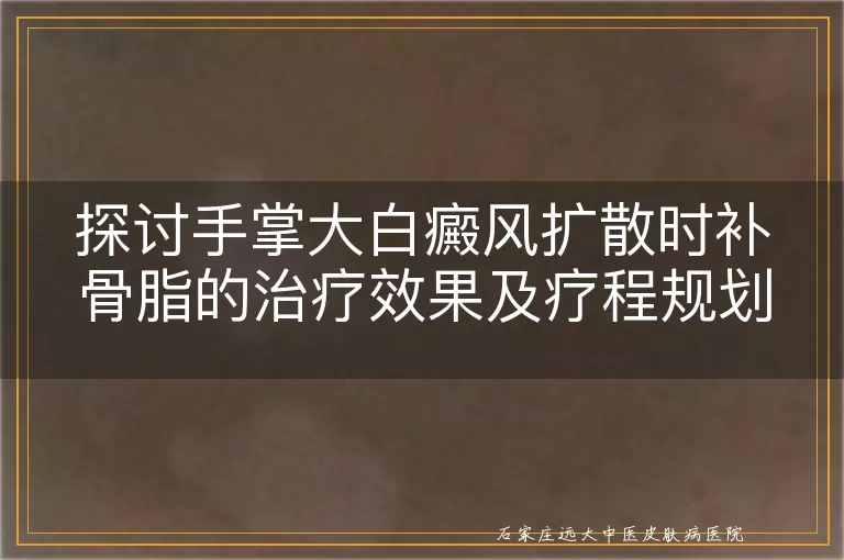 探讨手掌大白癜风扩散时补骨脂的治疗效果及疗程规划