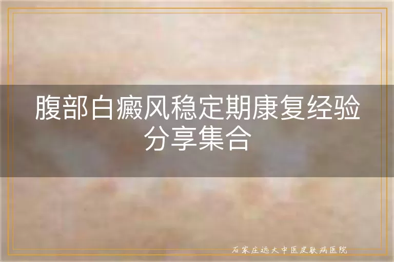 腹部白癜风稳定期康复经验分享集合