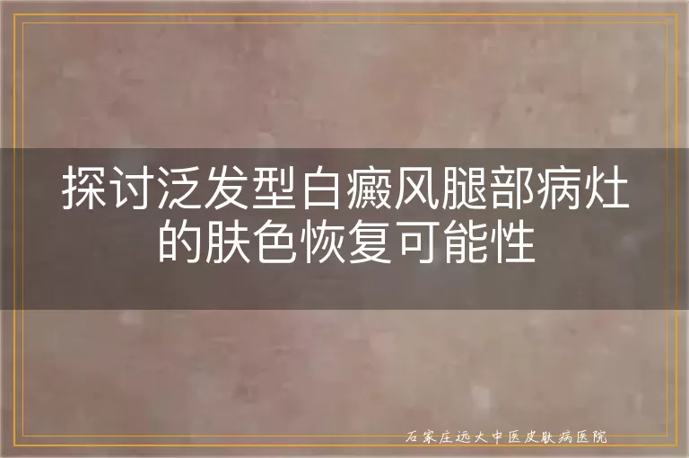 探讨泛发型白癜风腿部病灶的肤色恢复可能性