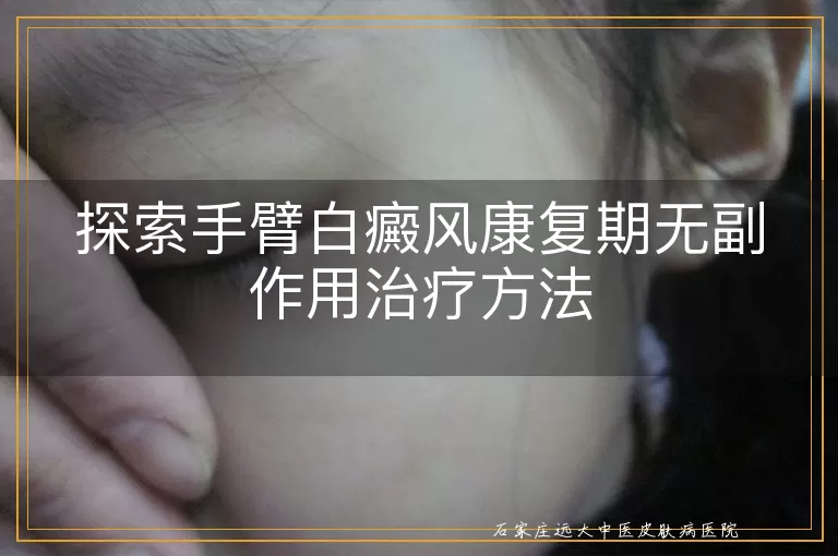 探索手臂白癜风康复期无副作用治疗方法