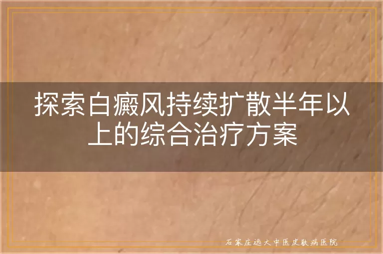 探索白癜风持续扩散半年以上的综合治疗方案