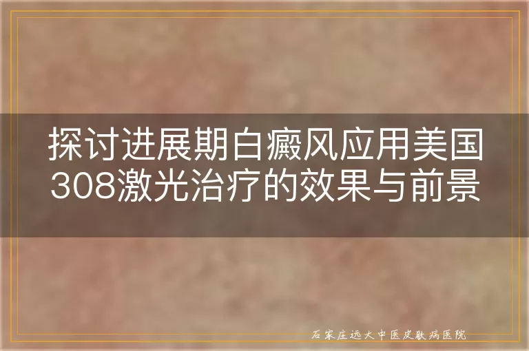 探讨进展期白癜风应用美国308激光治疗的效果与前景