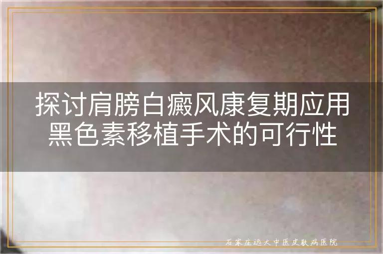 探讨肩膀白癜风康复期应用黑色素移植手术的可行性