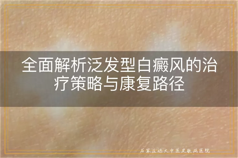 全面解析泛发型白癜风的治疗策略与康复路径