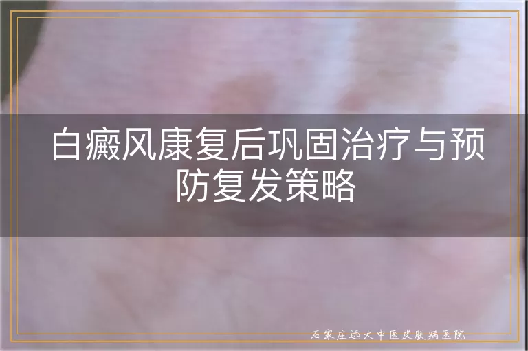 白癜风康复后巩固治疗与预防复发策略