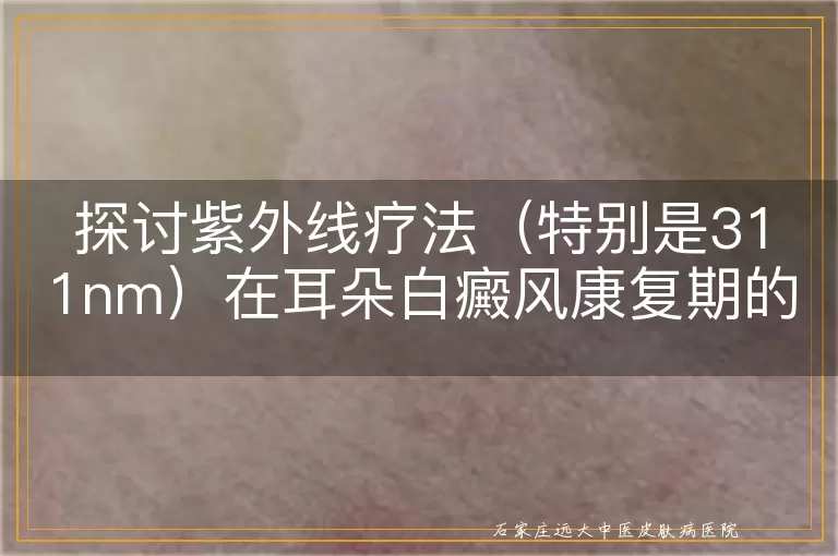 探讨紫外线疗法（特别是311nm）在耳朵白癜风康复期的应用与疗效