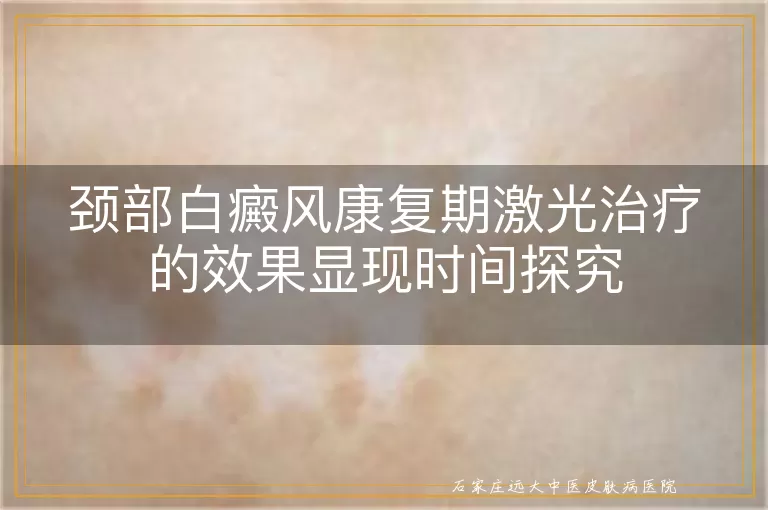 颈部白癜风康复期激光治疗的效果显现时间探究