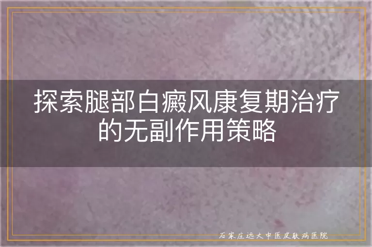 探索腿部白癜风康复期治疗的无副作用策略