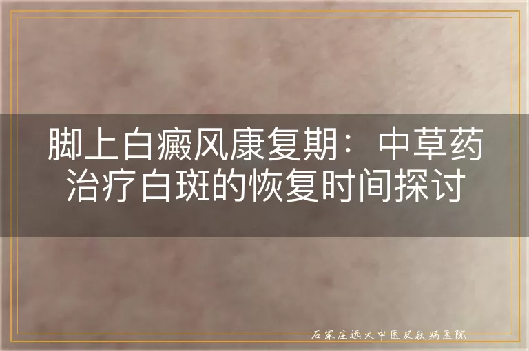 脚上白癜风康复期：中草药治疗白斑的恢复时间探讨
