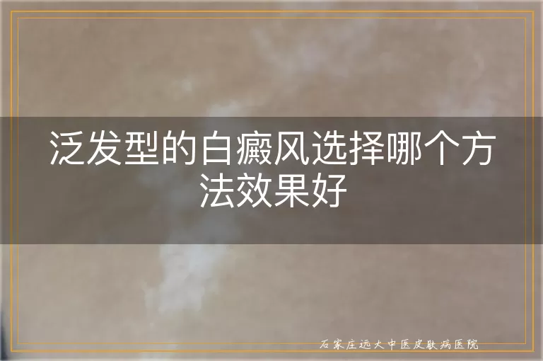 泛发型的白癜风选择哪个方法效果好