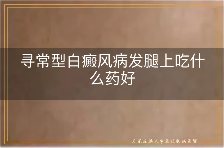 寻常型白癜风病发腿上吃什么药好