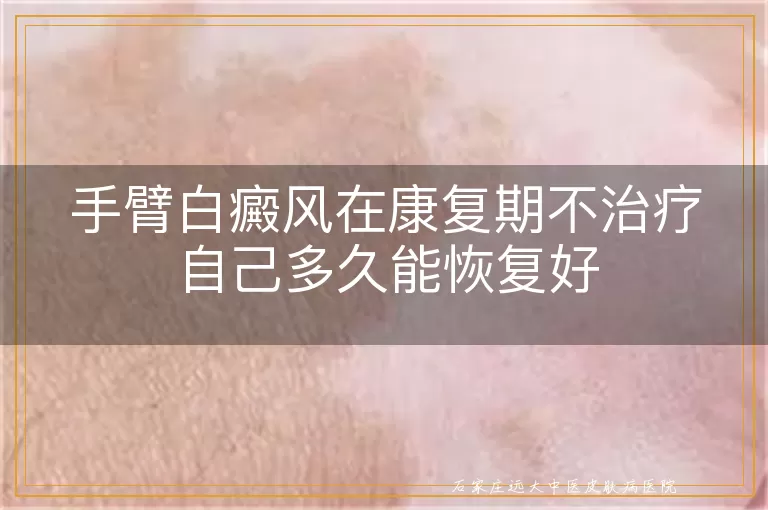 手臂白癜风在康复期不治疗自己多久能恢复好