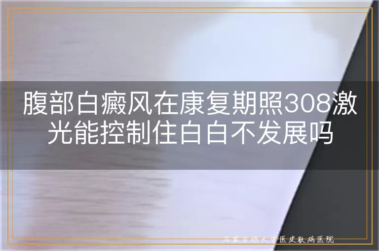 腹部白癜风在康复期照308激光能控制住白白不发展吗