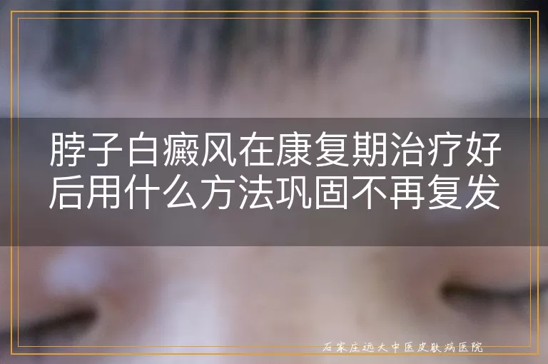 脖子白癜风在康复期治疗好后用什么方法巩固不再复发