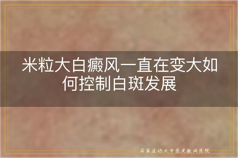 米粒大白癜风一直在变大如何控制白斑发展