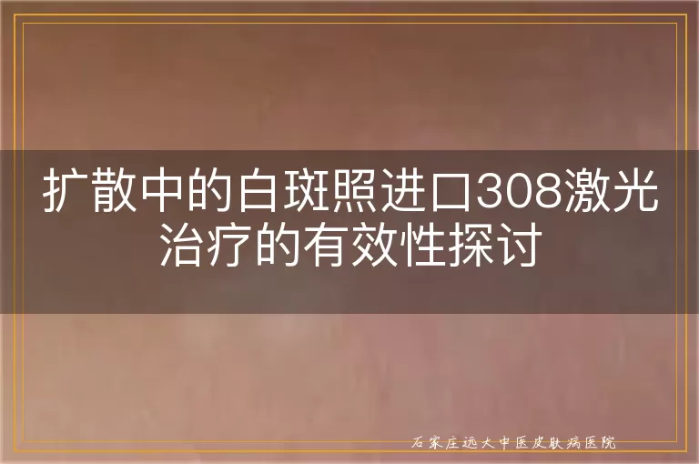扩散中的白斑照进口308激光治疗的有效性探讨