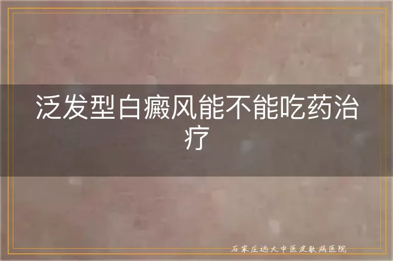 泛发型白癜风能不能吃药治疗