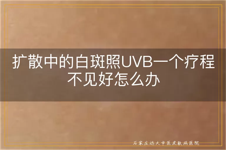 扩散中的白斑照UVB一个疗程不见好怎么办