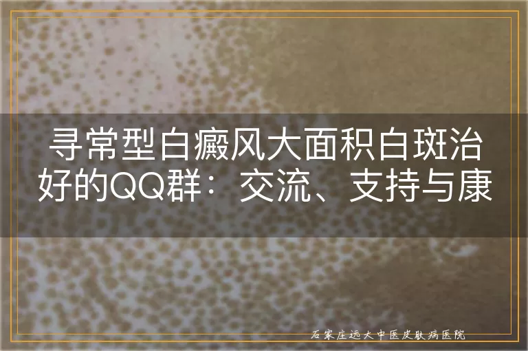 寻常型白癜风大面积白斑治好的QQ群：交流、支持与康复之路