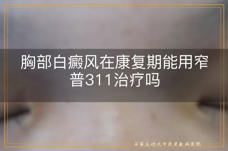 胸部白癜风在康复期能用窄普311治疗吗