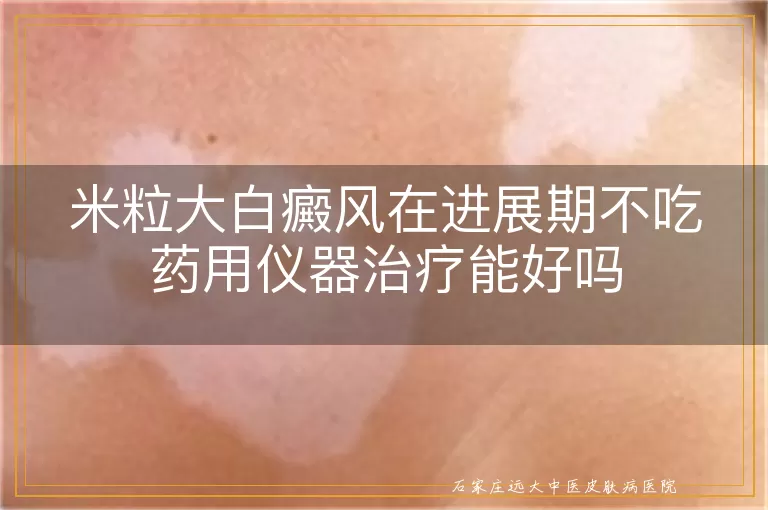米粒大白癜风在进展期不吃药用仪器治疗能好吗