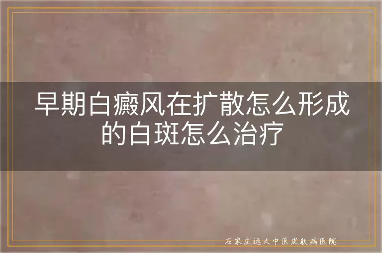 早期白癜风在扩散怎么形成的白斑怎么治疗