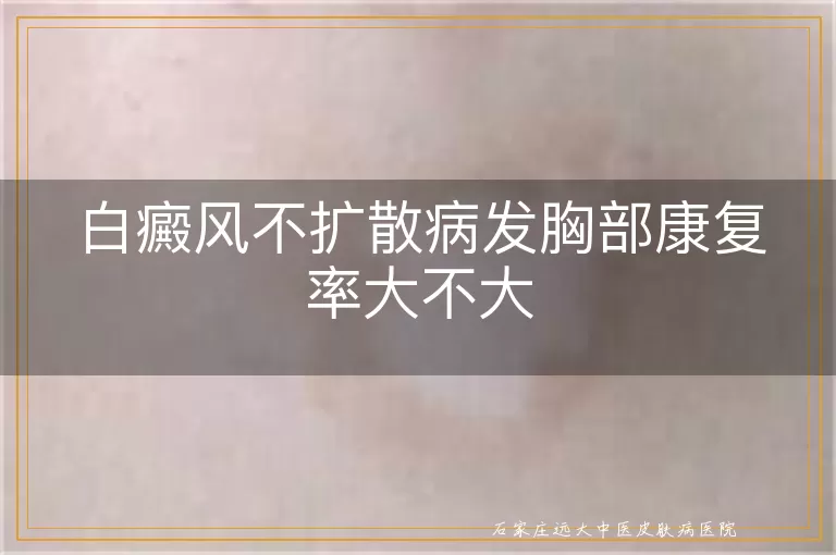 白癜风不扩散病发胸部康复率大不大