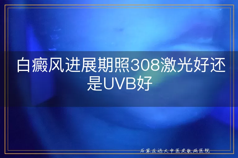 白癜风进展期照308激光好还是UVB好