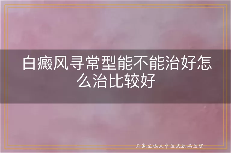 白癜风寻常型能不能治好怎么治比较好