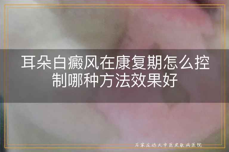 耳朵白癜风在康复期怎么控制哪种方法效果好