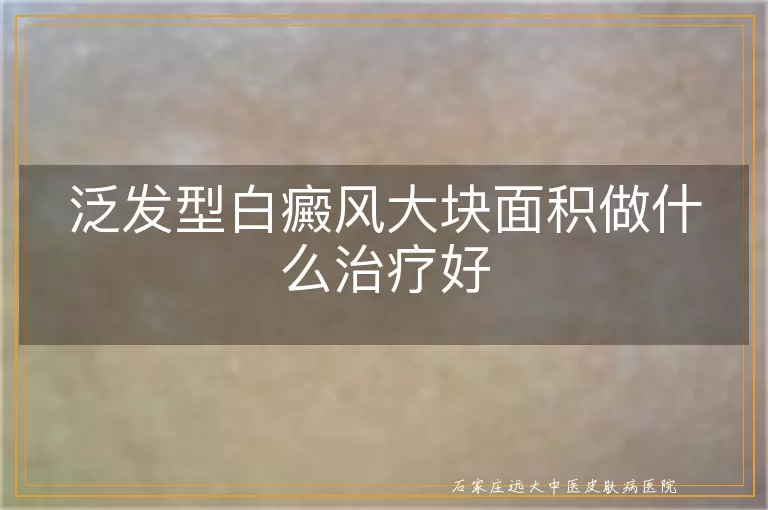 泛发型白癜风大块面积做什么治疗好
