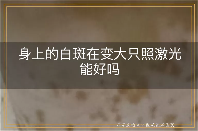 身上的白斑在变大只照激光能好吗