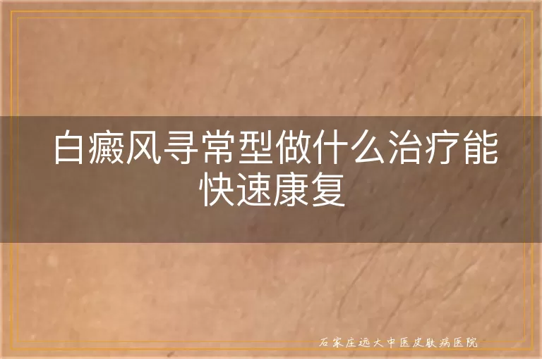 白癜风寻常型做什么治疗能快速康复