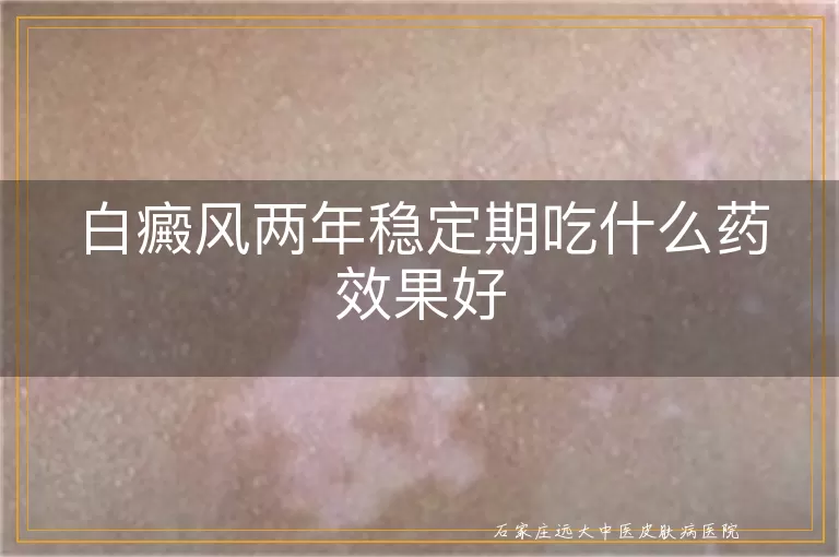 白癜风两年稳定期吃什么药效果好