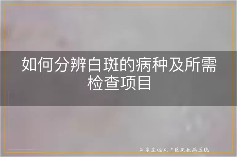 如何分辨白斑的病种及所需检查项目