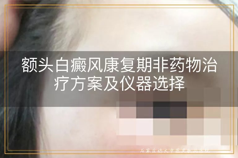 额头白癜风康复期非药物治疗方案及仪器选择