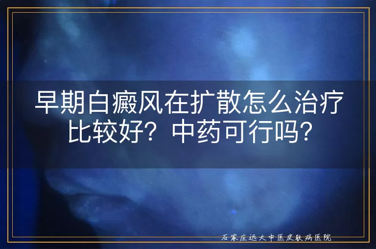 早期白癜风在扩散怎么治疗比较好？中药可行吗？