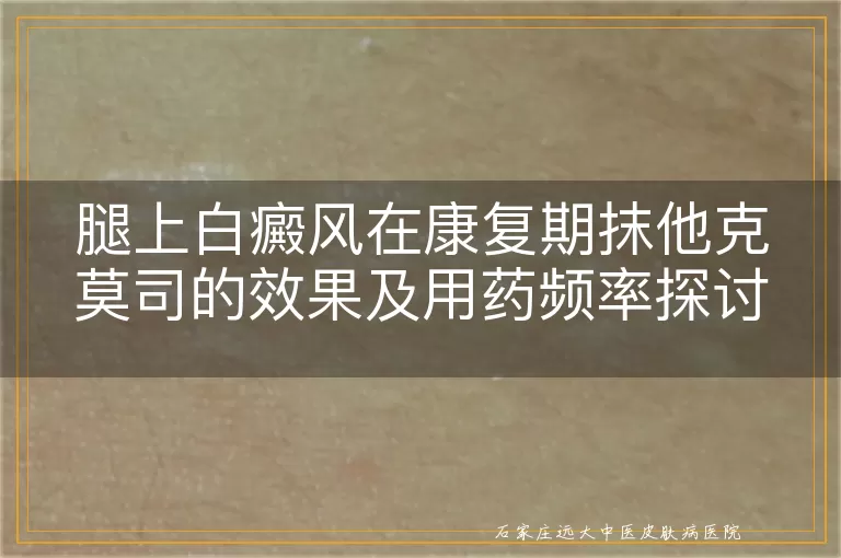 腿上白癜风在康复期抹他克莫司的效果及用药频率探讨