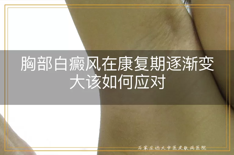 胸部白癜风在康复期逐渐变大该如何应对
