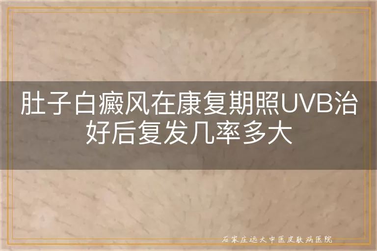 肚子白癜风在康复期照UVB治好后复发几率多大