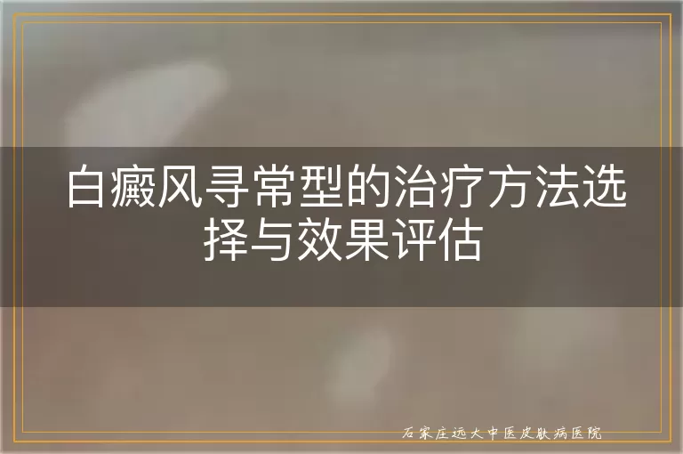 白癜风寻常型的治疗方法选择与效果评估