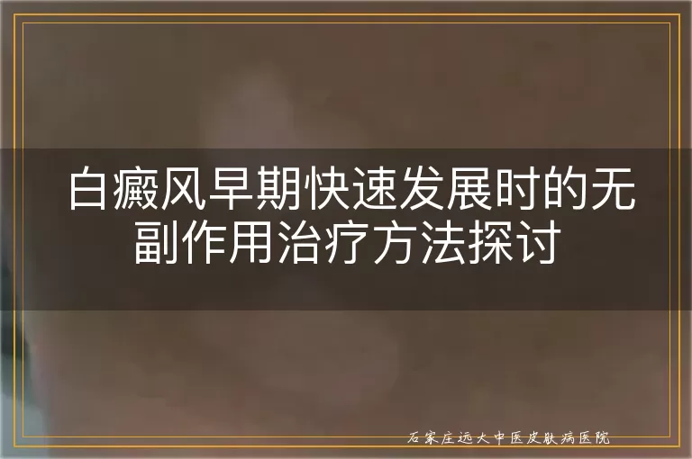 白癜风早期快速发展时的无副作用治疗方法探讨
