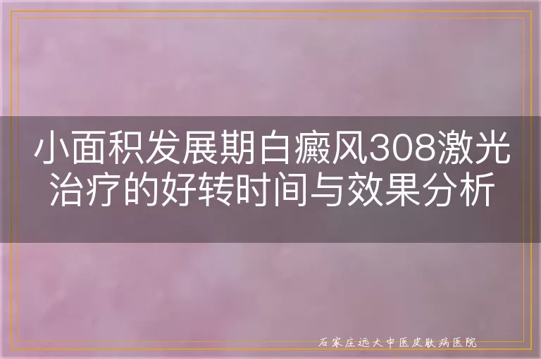 小面积发展期白癜风308激光治疗的好转时间与效果分析