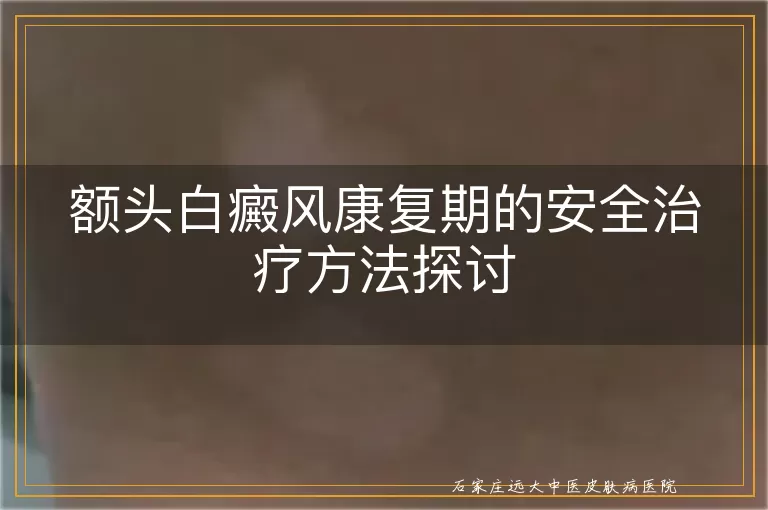 额头白癜风康复期的安全治疗方法探讨