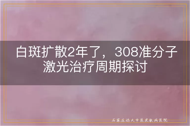 白斑扩散2年了，308准分子激光治疗周期探讨