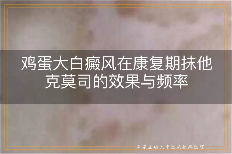 鸡蛋大白癜风在康复期抹他克莫司的效果与频率