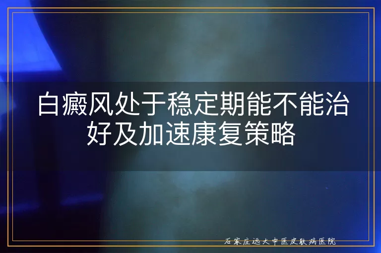 白癜风处于稳定期能不能治好及加速康复策略