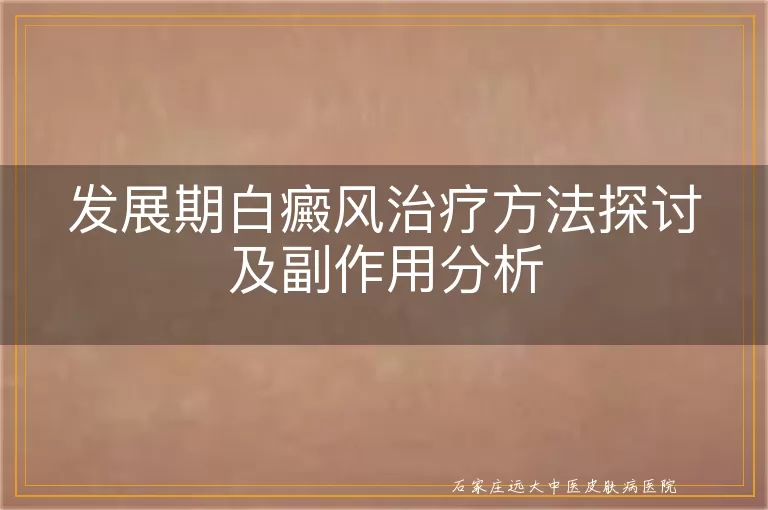 发展期白癜风治疗方法探讨及副作用分析
