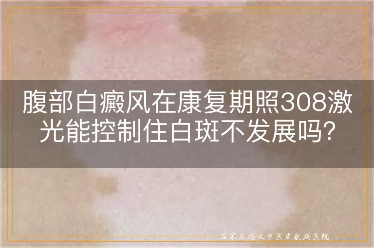 腹部白癜风在康复期照308激光能控制住白斑不发展吗？