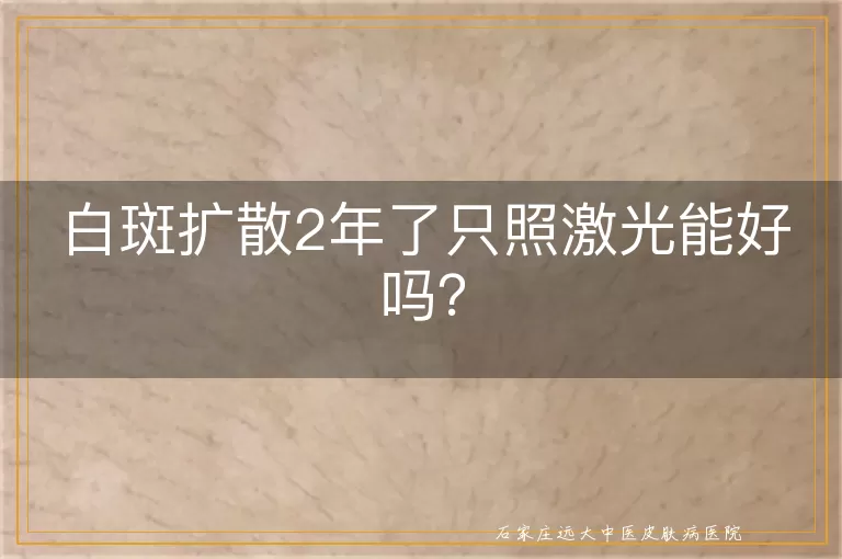 白斑扩散2年了只照激光能好吗？